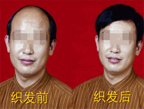 韓美黛織發(fā)補(bǔ)發(fā)