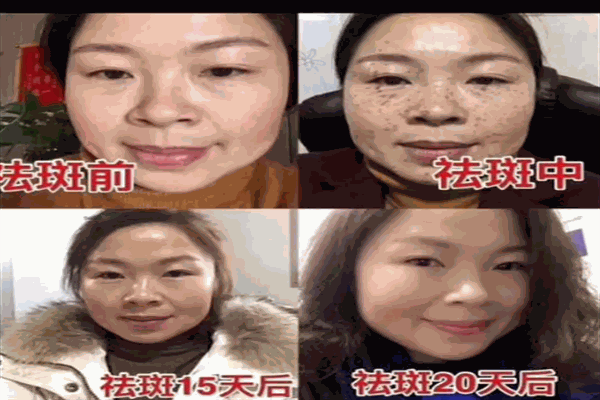豆蔻九九加盟